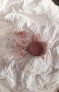 حجر هبهاب نازف مال ملاكط اللكيته البيع 07722058779