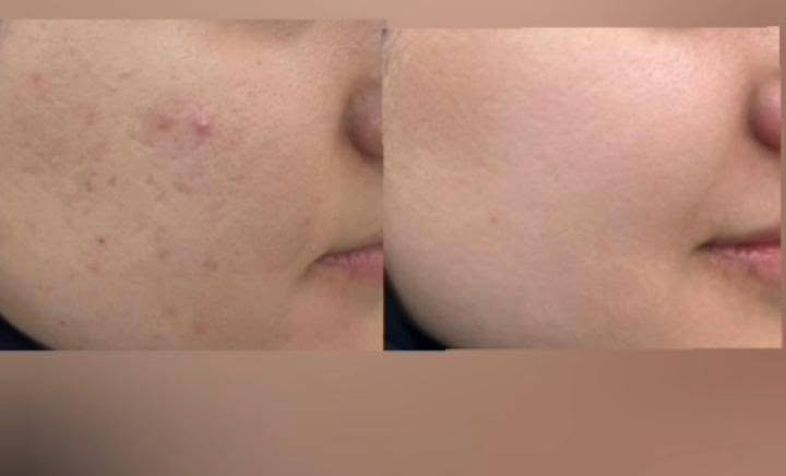 هلو بنات جبتلكم بكج كامل سيروم وكريم وصابونه للوجه اذا مو  من اول اسبوع شوفين فرق ترجعيه موجود توصيل بغداد ومحافظات وبسمايه


**إذا كنت صاحب هذا الإعلان وتريد حذفه لأي سبب، رجاءا أرسل رسالة إلى الدعم الفني**