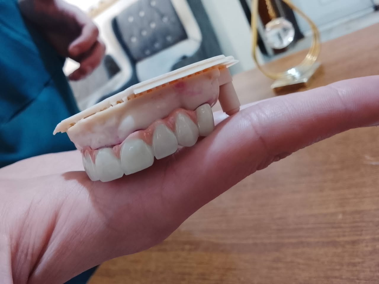 تعلن عيادات إبرو لطب الاسنان وتجميل عن عروض وتخفيضات في قسم الأسنان والتجميل مكانه  ماجديه نهاية شارع الجامع مقابيل مأكولات البيك ***********
