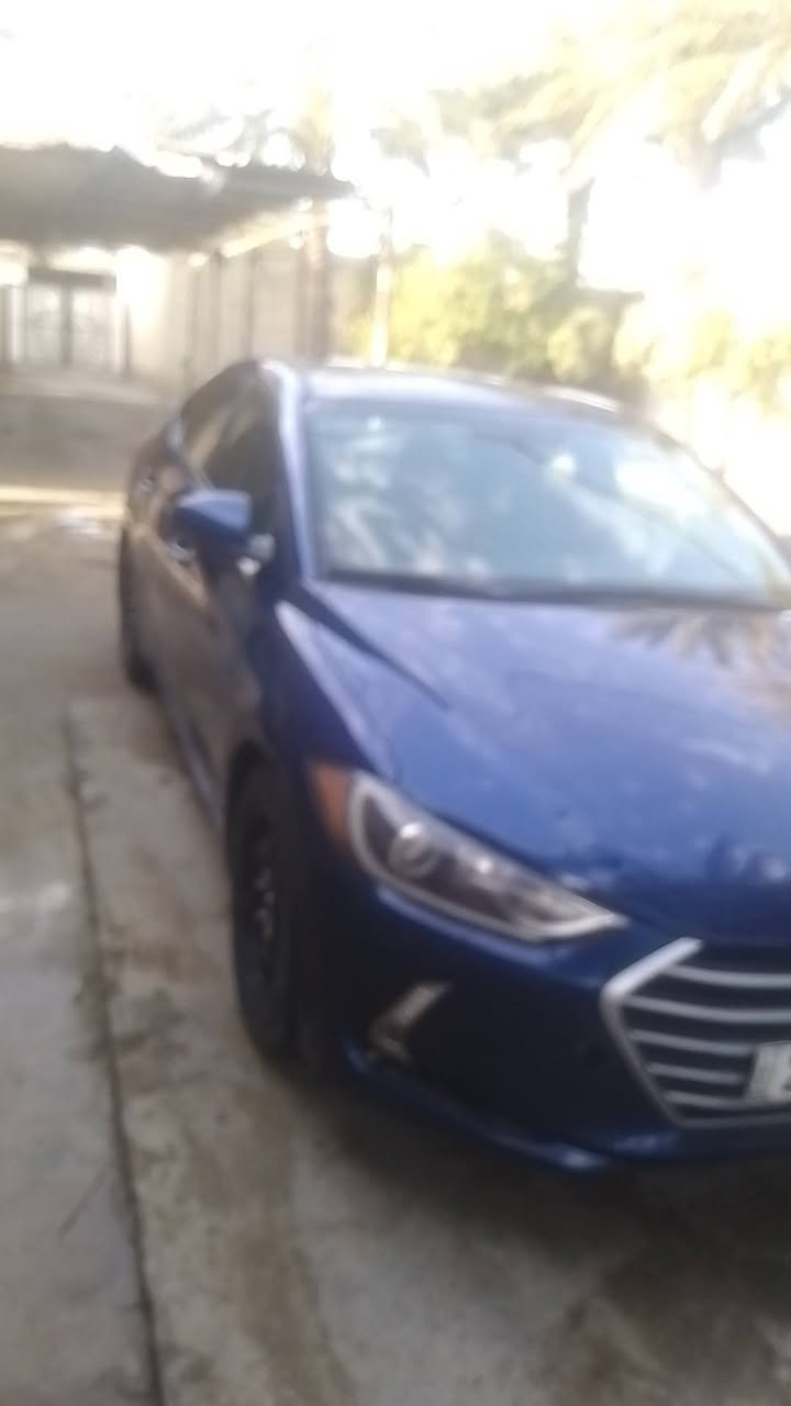 النترا 2018
لون ازرق  
رقم اربيل بسمي تحويل مباشر
هزة ورقم وسنوية جديد
قطعتين صبغ
وقطعة تبديل
شواصي لغود حوض كفالة
العنوان بغداد الدورة 
السعر 115 
***********
