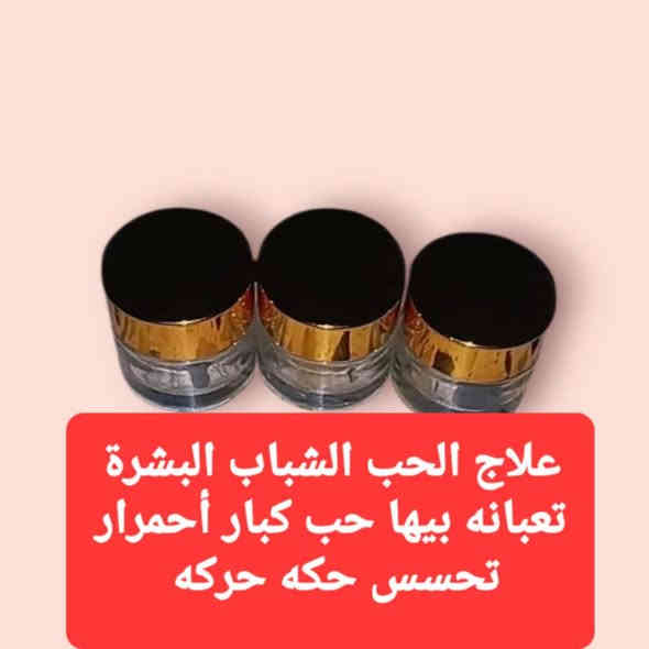 السلام عليكم  حبايبي اشلونكم 🟢
شغلي خاص حلاقين صالونات كوزمتك محلات مبيعات 🟡
شغلي فقط ☑️
خلطه تبيض الوجه وكلف ونمش تصبغات ☺️😊
نوع ثاني علاج الحب ♥ الشباب البشرة تعبانه بيها حب كبار أحمرار تحسس حكه حركه 😡🥵🤒
نوع ثالث زيت شعر بالاعشاب طبيعية شعر يمنع التساقط يثخن يطول يملي الفراغات يستخدم الحيه او شعر 💇‍♀️💇 الأسعار مناسبة حلوة 
نوع رابع شانبو طبي ضد القشرة الحكه تساقط الشعر خشن شيب  غذائية اساسية نشطة بيولوجيا تعمل تحسين حالة شعر فروة الراس  مما يخلق بيئة  صحية ونظيفة  النمو الشعر
الأسعار مناسبة حلوة  اي استفسار مراسله الصفحة او الحجز واتساب فقط  
***********
منتجات ضمان من قبل دكتور تجميل وجلديه صحه 
تحياتي للجميع
@إشارة
