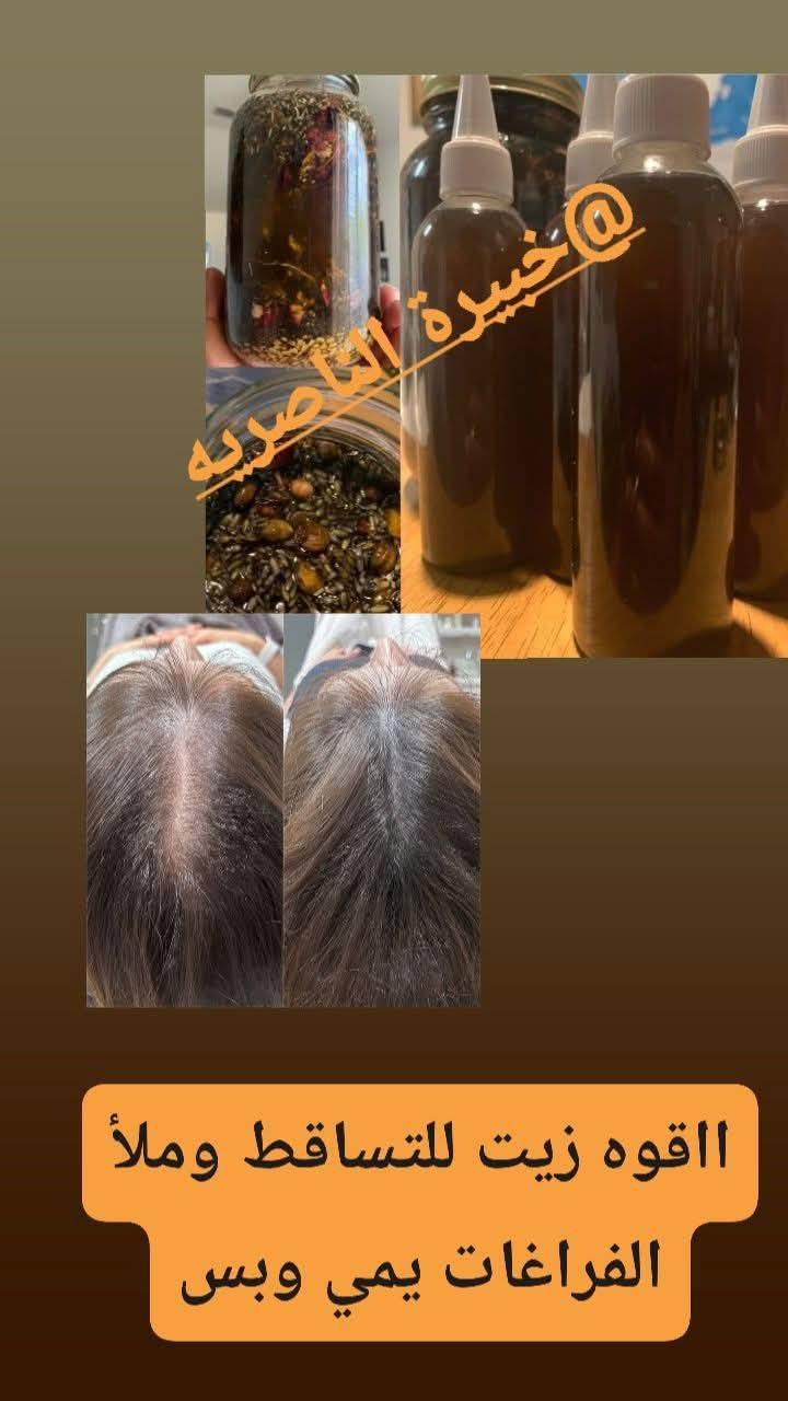 الله شاهد تاخذو تدعولي منتجات عصر ع بارد ومجربة
والله الي تجربني مره ترجع الف مره تشكرني  والقرآن منتجات تخبل تخبل كل فلس بيه حلال

توصيل مجاني


**إذا كنت صاحب هذا الإعلان وتريد حذفه لأي سبب، رجاءا أرسل رسالة إلى الدعم الفني**