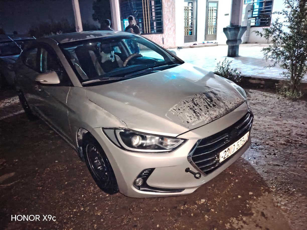 النترا مديل 2018 خليجي حادث فقط في العراق  للتواصل الاتصال على الرقم
0783 843 5008
