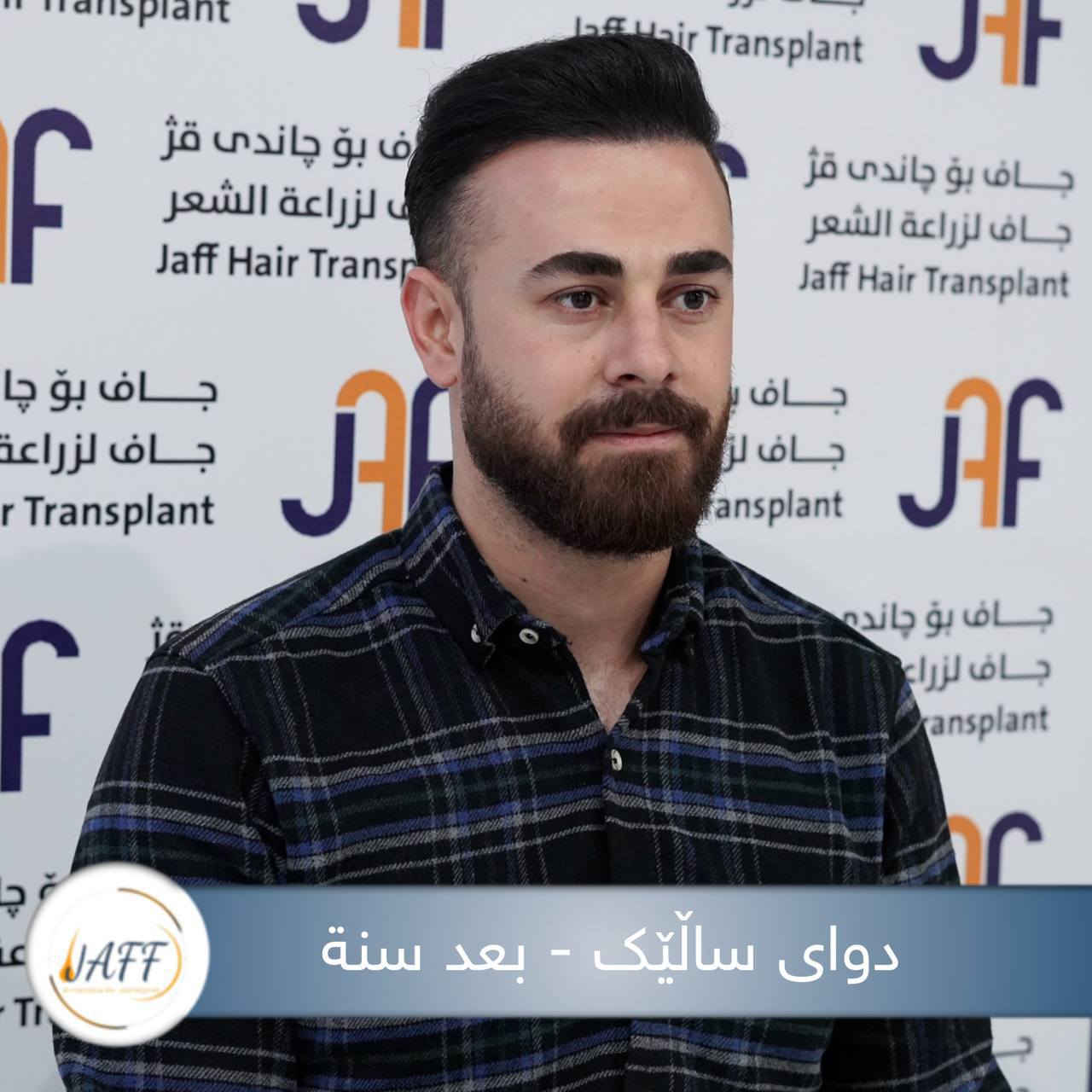 بعد زراعة الشعر في مركز جاف ستحصل على أجمل ستايل جديد ومظهر أكثر ثقة وجاذبية، لذلك ليكن خيارك الدائم هو مركز جاف للحصول على أفضل النتائج.

♦  مع جاف حافظ على شبابك.

📍 العنوان: كلار، عمارة جاف الطبية،  شارع رئيسي سوق - حي الموظفين مقابل مكتب حزب یەکگرتو سابقا.

📞 رقم التواصل:
***********
🔹🔹🔹🔹🔹🔹🔹🔸🔸🔸🔸🔸🔸🔸🔸
دوای چاندنەوەی قژ لە سەنتەری جاف ، ستایلێکی نوێ و جوان بەدەست دەهێنیت. بۆیە باشترین هەڵبژاردەت سەنتەری جافە بۆ گۆڕینی دیمەن و ڕوخسارت .

♦ لەگەڵ جاف هەمیشە بەگەنجی دەمێنێتەوە 

📍  ناونیشان: کەلار، تەلاری پزیشکی جاف، بەرامبەر مەڵبەندی یەکگرتوو .

📞  ***********
