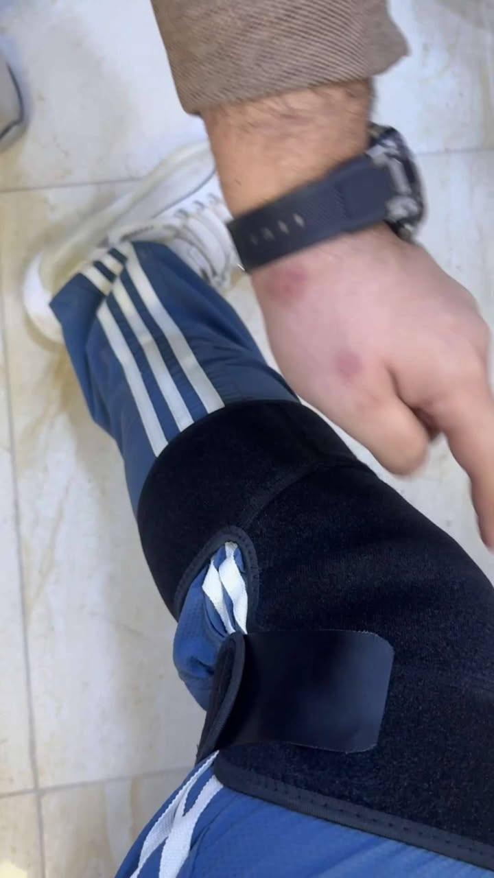 ودّع آلام الركبة وارجع لحركتك الطبيعية 💪

دعامة الركبة المغناطيسية تمنحك دعماً ثابتاً وراحة فورية بفضل التسخين الذاتي والعلاج المغناطيسي الذكي 🔥

تصميم مريح، تهوية ممتازة، وثبات عالي بدون إزعاج.

مثالية للرياضة، المشي، العمل اليومي أو حتى الجلوس الطويل.

حل عملي لكل من يعاني من آلام الركبة بدون كهرباء أو تعقيد.

راحة تشعر بها من أول استخدام ✨

💲 السعر::  20 الف 
🚛 التوصيل مجاني لكل المحافظات 
 للحجز مراسلة الصفحه او واتساب ***********
