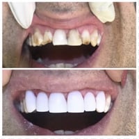 🔥🔥🔥العررررررررررررض 🔥🔥🔥الي ماله مثيل العررررض الخرافي 💖 عررررررض الأحل...