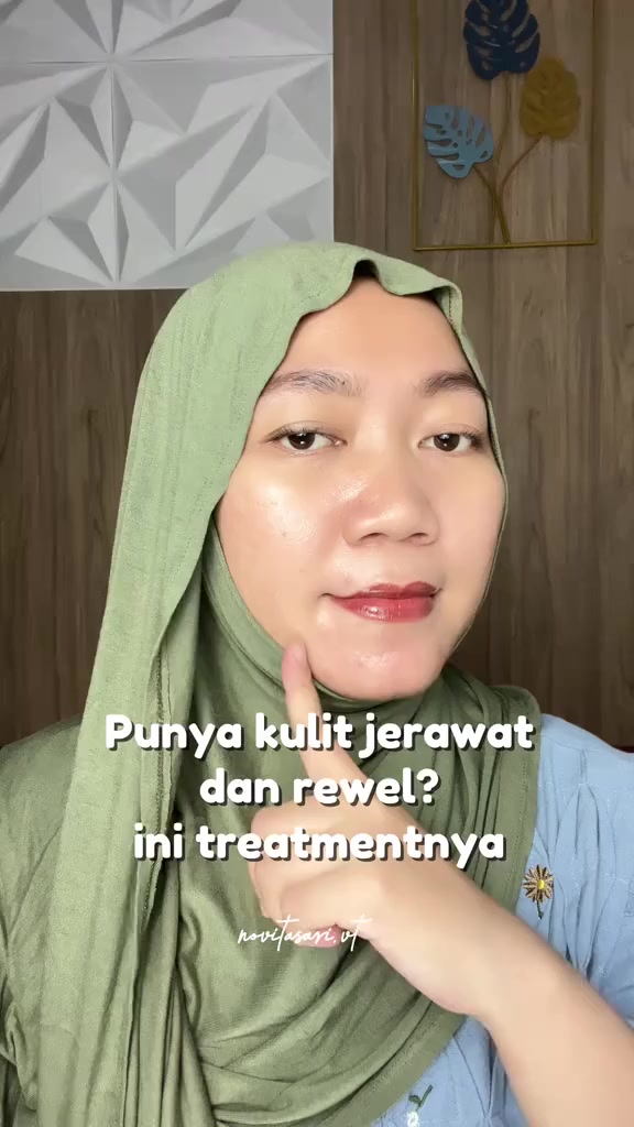 💚مجموعة المعجزة (AHA BHA PHA 30 Days Miracle AC SOS Kit) من العلامة التجارية الكورية سوم باي مي (SOME BY MI). صُممت خصيصاً كروتين متكامل للعناية بالبشرة المعرضة لحب الشباب والمشاكل الجلدية، حيث تعتمد على ثلاثة أنواع من أحماض التقشير (AHA و BHA و PHA) لتنظيف المسام وتجديد خلايا الجلد. 

✨محتويات المجموعة (4 قطع بأحجام مخصصة للتنقل):تتضمن المجموعة أربع خطوات أساسية للعناية اليومية: 
✔️1منظف (Miracle Acne Clear Foam): غسول يعمل على تنظيف البشرة وإزالة الشوائب والدهون الزائدة.
✔️2تونر (Miracle Toner): يساعد في تقشير البشرة بلطف وتقليص حجم المسام الواسعة.
✔️3سيروم (Miracle Serum): يعمل على تهدئة البشرة وتقوية حاجزها الطبيعي.
✔️4كريم (Miracle Cream): يوفر الترطيب اللازم ويساعد في علاج الحبوب وآثارها. 

✅أبرز الفوائد:-
علاج حب الشباب: تساعد المكونات الفعالة مثل ماء أوراق شجرة الشاي في تقليل الالتهابات وعلاج البثور.
تنقية المسام: تعمل الأحماض على إزالة الخلايا الميتة والرؤوس السوداء والبيضاء، مما يقلل من ظهور المسام الواسعة.
تحسين ملمس البشرة: تساهم في تنعيم البشرة الخشنة وزيادة نضارتها خلال 30 يوماً من الاستخدام المنتظم. 
#الاصلي المنشأ كوريا 🇰🇷💯
السعر 25 الف
🚘يوجد خدمة توصيل لجميع محافظات العراق ٤ 🚘#جمالج_يهمنا #بنات_العراق #نصائح_بنات


**إذا كنت صاحب هذا الإعلان وتريد حذفه لأي سبب، رجاءا أرسل رسالة إلى الدعم الفني**