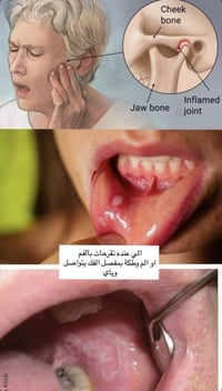 العلاج مجاني ٠٧٧٠٨٠٥٦٧١٩