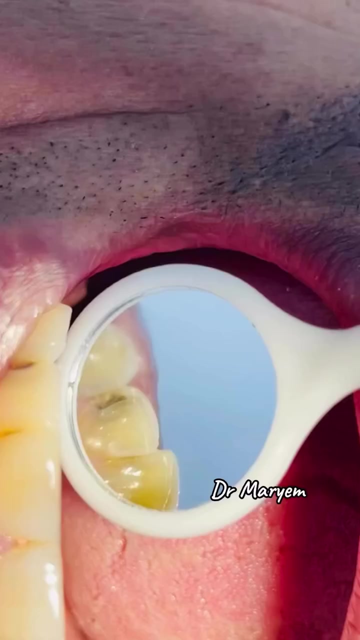 للحجز والاستفسار ***********
