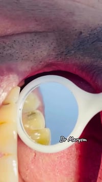 للحجز والاستفسار 07748693664