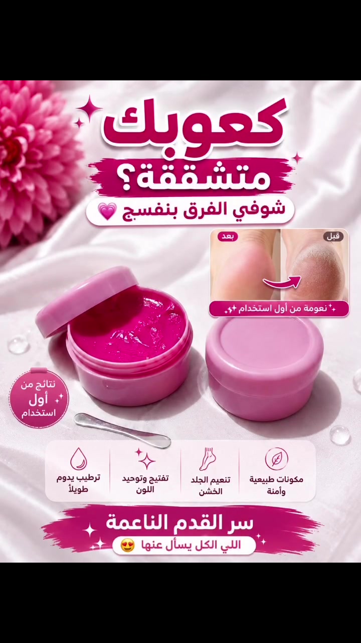 خلي صندل العيد يبين جمال كعب القدم  😳😳😳


**إذا كنت صاحب هذا الإعلان وتريد حذفه لأي سبب، رجاءا أرسل رسالة إلى الدعم الفني**