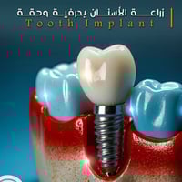 عياده الدكتور عماد عطاالله لزراعه وتقويم الاسنان رقم عياده 07876409650