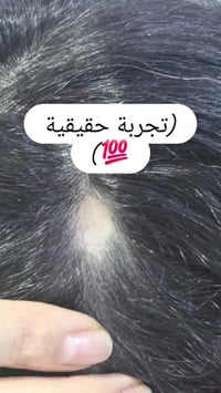 باليا الوردية • أمبول Seabury • انبات الشعر