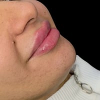 جمال الشغل لفلر الشفه  ١سيسي 😇 الفلر الالماني من شركة دايفز بيد الدكتو...