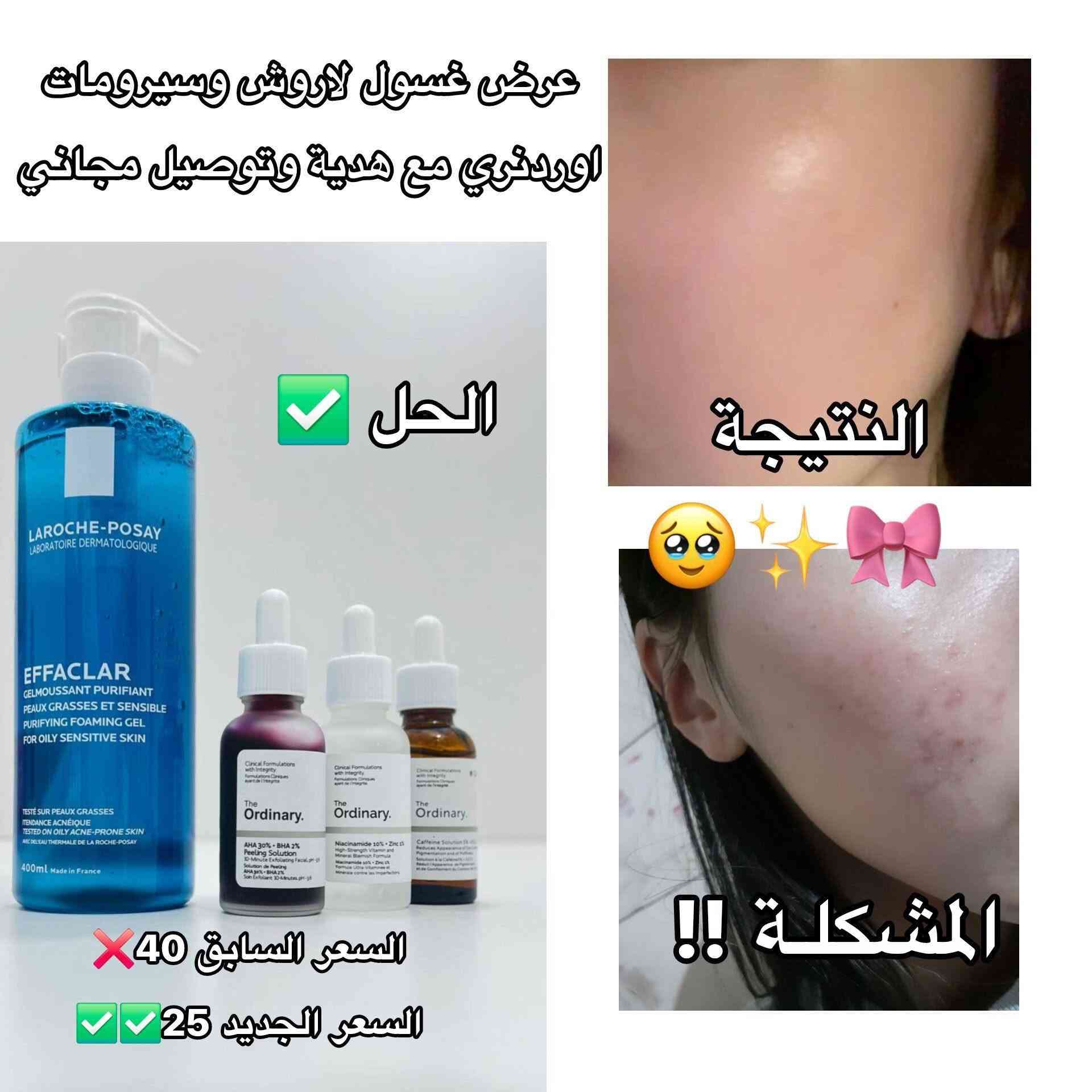 بناتتتت🍓🫶🏻😭 سويت مسابقـة بمتجري على بكج glow skin 💘💘للـبشرةأول 5 بـنـات يراسلوني راح يحصلون على هدية وتوصيل مجاني 😭🫰🏻
✨ يخفف الـحبوب والآثار والتصبغات
✨ يعطي نضارة ولـُمعة⏰ ينتهي اليوم !
يلا أول5 يكتبن "تم" خاص تفوز 🤏🏻


**إذا كنت صاحب هذا الإعلان وتريد حذفه لأي سبب، رجاءا أرسل رسالة إلى الدعم الفني**