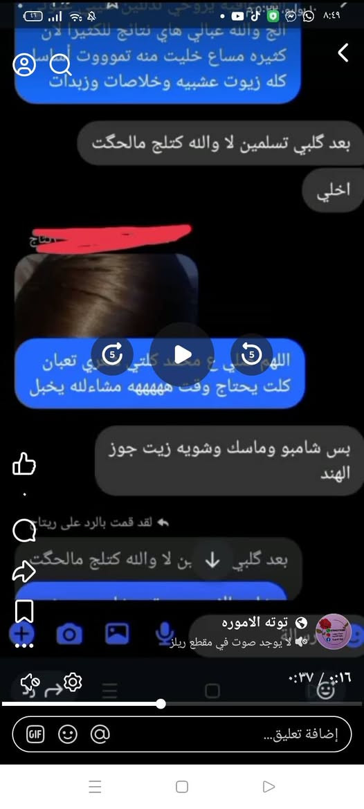 صباح الخير كل عام وانتم بخير صحه وعافيه 
خلص العيد نرجع للشغل ارفعو المنشور ب لايك وتعليق ❤️ 
✨🔥 ودّعي تساقط الشعر والنفشة نهائياً 🔥✨
💥 معالج الشعر الخرافي 💥
زيت باروكه مخمّر 🌿 بأكثر من 20 عشبة طبيعية
يغذي الشعر من الجذور 💧
يعالج:
✔️ التساقط
✔️ النفشة
✔️ الهيشان
✔️ الجفاف
✨ ويخلي شعرج ناعم ولامع بشكل يخبّل ✨
🌴💛 مكيف الشعر الطبيعي 💛🌴
بـ جوز الهند + زبدة الشيا
ترطيب عميق من أول استعمال 💧
✔️ تنعيم فوري
✔️ يقضي على النفشة
✔️ يعالج الهيشان
✔️ نتيجة واضحة جداً من أول مرة 😍
📦 الحجم: ربع كيلو
يكفيج أكثر من شهرين 👌
🎁🔥 عرض نااار 🔥🎁
بدل 20
💸 هسه بس بـ 16
🚚 توصيل مجاني
⏳ لا تفوتين الفرصة… شعرك يستاهل العناية 👑
راسلينا واحجزي قبل نفاذ الكمية 💌


**إذا كنت صاحب هذا الإعلان وتريد حذفه لأي سبب، رجاءا أرسل رسالة إلى الدعم الفني**