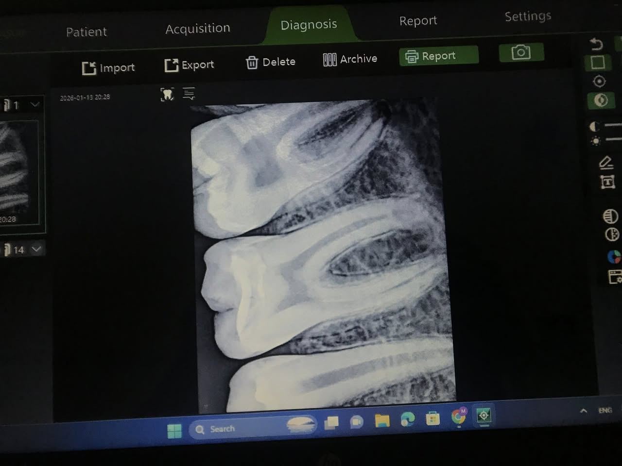 جهاز بورتبل + سنسر اشعه ، جديد فتح على كد التجربه فقط ، السعر خاص


**إذا كنت صاحب هذا الإعلان وتريد حذفه لأي سبب، رجاءا أرسل رسالة إلى الدعم الفني**