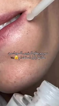 تقشير بالأرز • أحماض AHA/BHA/PHA • نياسيناميد