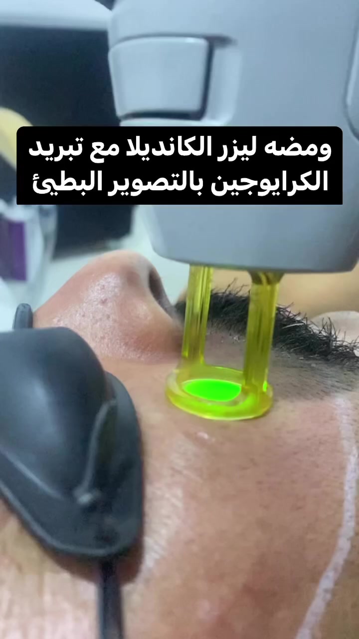 عروض الليز كانديلا الثلجي احدث اصدار🤩🤩
للنساء والرجال يوجد كادر #خاص 
يعني النتيجه من اول جلسة :-
فل بدي 100,000
مني فل بدي 75,000
بكيني& اندر ارم 35,000
بكيني 25,000
اندر ارم 15,000
ذراع كامل 15,000
نصف ذراع 10,000
قدم كامل 25,000
نصف قدم 15,000
وجه كامل 15,000
وجه & رقبة 20,000
رجالي 
وجنات 15,000
وجنات & رقبة 25,000
للحجز والاستفسار ***********
العنوان بسماية الشارع العام قرب كافية مستربن
