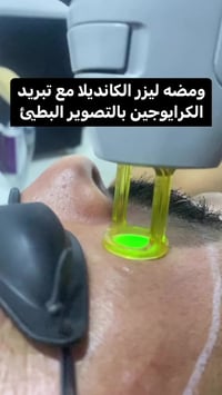 ليز كانديلا الثلجي • نساء ورجال • بسماية