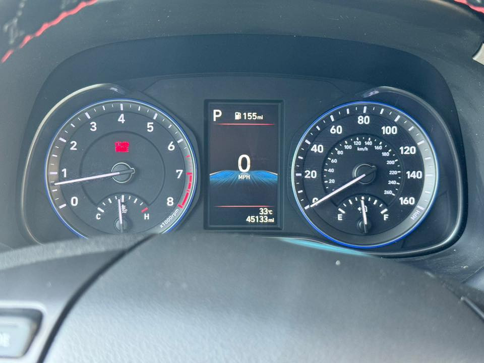 السلام عليكم
كونا للبيع موديل ٢٠٢٢
وارد امريكي
فول مواصفات 
صور الضرر مرفقة بالمنشور 
ماشية ٤٩ مايل 
السعر ١٦٠ ورقة وبيها مجال بسيط 
للاتصال:  ***********
