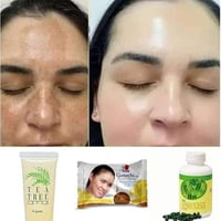 لكل مشاكل البشره لطلب المنتج التواصل مازنجر أو الواتساب 07780234015