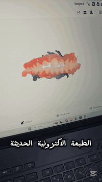 الطبعة الاكترونية الحديثة
لصناعة افضل تركيبات دقيقه 👍
✨️✨️✨️✨️✨️✨️✨️✨️✨️
عيادة الدكتور احمد البغدادي _شارع الاطباء _عمارة الدكتور سيف الجنابي 
*********** 
#جبلة #طب_اسنان #كوثى
