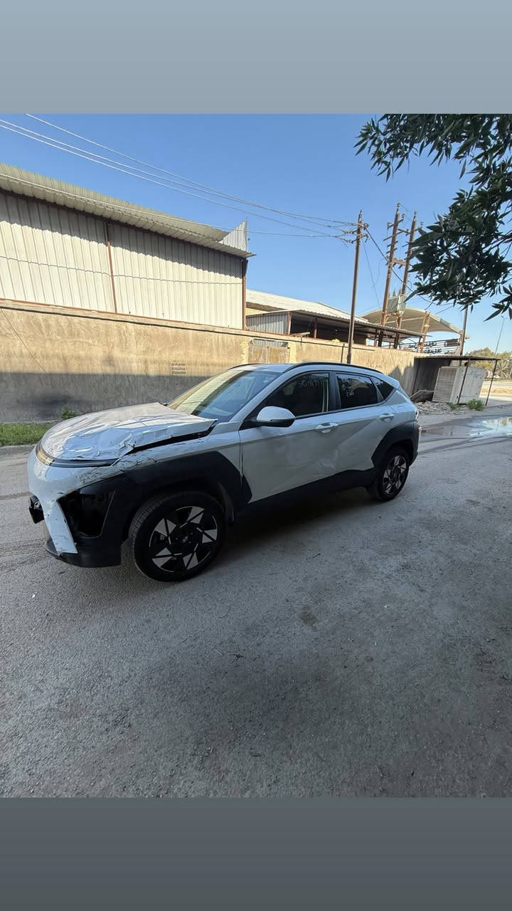 كونا 2025بدون رقم منفيس بسمي
زيرو ماشيه 2000

محرك 2000دوش مواصفات بصمه رادار شاشه متصل تدفىه كشنات وستيرن 

تحكمات تشغيل عن بعد باقي المواصفاتً

تباع على وضعها بدون رقم وتصليح 

السعر 144ورقه

الاتصال ***********

بغداد كراده
