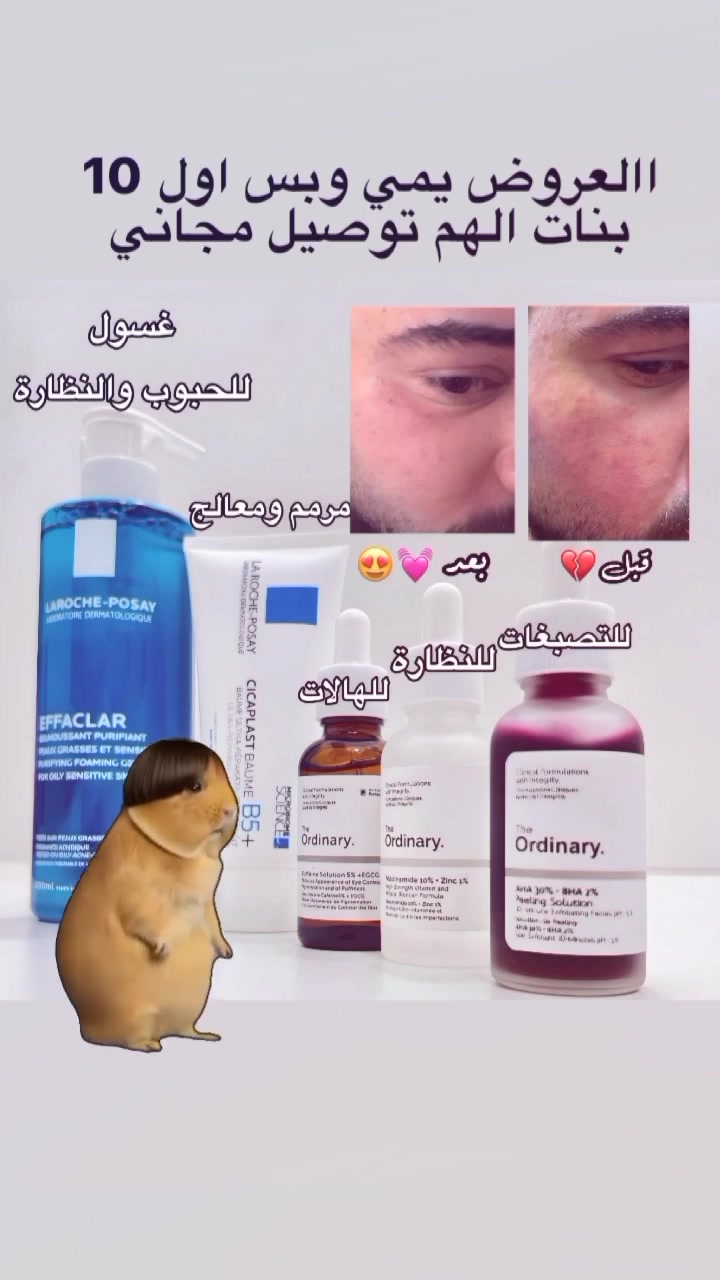 عرض العناية بالبشرة .#لايك_اشتراك #اكسبلور_فولو #Cosmetic  #الشعب_الصيني_ماله_حل 😂😂. #followher #followers #likeforlike #comment #s4s #follow4follow #comment4comment #f4f #followbackteam #followall #shoutouts #shoutoutback #instagood #followforfollow #like4like #c4c #commentbelow #commentback #l4l #follow #followhim #followme #likeall #follower #followback #shoutout #comments


**إذا كنت صاحب هذا الإعلان وتريد حذفه لأي سبب، رجاءا أرسل رسالة إلى الدعم الفني**