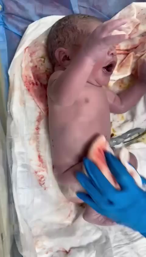 التميز والثقة في عالم النسائية والتوليد.. مع الدكتورة فادية ✨
لأن الأمومة هي أجمل رحلة بحياة كل امرأة، ولأن سلامتج وسلامة طفلج هي أولويتنا، الدكتورة فادية تفتح أبواب الأمل والرعاية لكل مراجعاتنا العزيزات.
ليش تختارين الدكتورة فادية؟
 * خبرة في الولادة الطبيعية: الدكتورة تدعم الولادة الطبيعية بكل صبر وطول بال، وتوفر لج كل سبل الراحة حتى تمرين بتجربة ولادة سهلة وآمنة وبأقل ألم.
 * دقة في العمليات القيصرية: إذا كانت حالتج تستوجب القيصرية، فلا تشيلين هم.. الدكتورة معروفة بدقتها العالية وخياطتها التجميلية المرتبة اللي تضمن لج أسرع تشافي وبدون أثار مزعجة.
 * بشرى سارة لحالات العقم وتأخر الإنجاب: بفضل الله وبخبرة الدكتورة الطويلة، عدنا سجل حافل بحالات نجاح الحمل بعد سنوات من الانتظار. تشخيص دقيق، علاج متطور، ومتابعة مستمرة لحد ما يتحقق حلم الأمومة وتسمعين كلمة "ماما".
خدمات العيادة المتكاملة:
 * متابعة الحمل الاعتيادي والحمل عالي الخطورة بدقة متناهية.
 * علاج حالات العقم الأولي والثانوي وتكيس المبايض بأحدث الطرق.
 * إجراء العمليات النسائية بكافة أنواعها (تجميلية وجراحية).
 * سونار متطور لمتابعة نمو الجنين وفحصه الشامل.
الدكتورة فادية.. مو بس دكتورة، هي أخت وسند لكل مراجعة. خبرة، أمانة، ونتائج مضمونة بإذن الله.
📍 العنوان: [سبع البور شارع السوداني مجمع الحياة الطبي]
(ايام تواجد الدكتور الاحد الثلاثاء و الخميس ثلاث ايام في السبوع) 
📞 للحجز والاستفسار: [***********]
