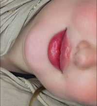 عروض فلر الشفة للتواصل 07755597827