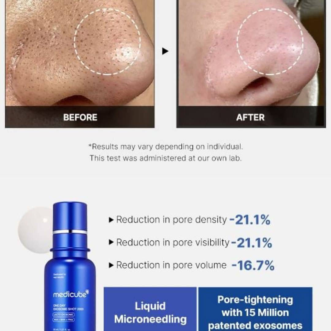 ✨سيروم ميديكوب ون داي إكسوسوم شوت بور أمبول 2000 (Medicube One Day Exosome Shot Pore Ampoule 2000)

🧬 تقنية الإكسوسوم المتقدمة
يحتوي السيروم على 2000 جزء في المليون من الإكسوسومات، وهي جزيئات دقيقة متطورة تساعد على تجديد خلايا البشرة، تحسين صحتها، وتعزيز نعومة وملمس الجلد.
🫧مصمم خصيصًا لاستهداف المسام الواسعة والرؤوس السوداء، ويساعد على تقليل مظهرها بشكل ملحوظ مع إحساس فوري بشد وتنقية المسام.
🧪 تقشير لطيف وفعّال
يجمع بين أحماض:AHA لإزالة خلايا الجلد الميتة BHA لتنظيف المسام بعمق PHA لتقشير لطيف مع ترطيب
يساعد هذا المزيج على تجديد البشرة دون التسبب بتهيج كبير.
📌 تعزيز الامتصاص العميق
تعتمد التركيبة على تقنية الإبر الدقيقة (Spicules) التي تساعد على اختراق الطبقات السطحية من الجلد وتعزز امتصاص المكونات النشطة بعمق داخل البشرة.

🌿 مناسب لجميع أنواع البشرة
تم اختباره سريريًا ليكون: منخفض التهييج . مضاد للحساسية غير مسبب للرؤوس السوداء مناسب للاستخدام اليومي، حتى للبشرة الحساسة والمعرضة لحب الشباب.
#الاصلي المنشأ كوريا 🇰🇷💯

🚘يوجد خدمة توصيل لجميع محافظات العراق 🚘 بغداد, العراق


**إذا كنت صاحب هذا الإعلان وتريد حذفه لأي سبب، رجاءا أرسل رسالة إلى الدعم الفني**