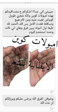 امبولات كوين • وقف التساقط • تكثيف الشعر