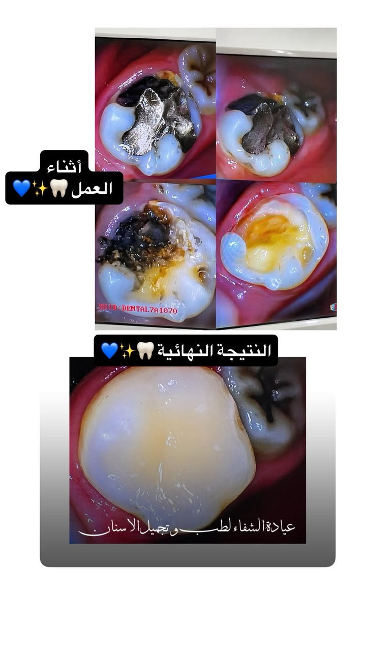 مراجعينا الكرام يتواجد الدكتور سرمد احمد التميمي في العيادة اليوم
للحجز خاص أو واتساب ***********
شارع ٦٠/ مقابل المستشفى الجديد
