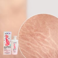 تشققات الحمل • كريم الأنوثة • تايلاند