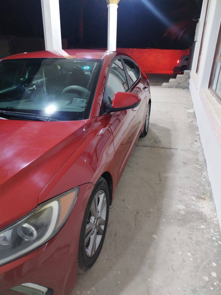 السلام عليكم
النتره موديل 18 وارد امريكي
رقم بابل بسمي انكليزي 
حادث السياره بس بنيد مصبوغ نفسه 
المواصفات نص فول 
منضومه زنون 
شاشه كبيره
تشغيل عن بعد
مكينه وكير وحداديه مكفولات 
وتخم تاير جدد
ماشيه mi 86 حقيقي
وبل عافيه عل ياخذهه 
الاستفسار اتصل ***********
