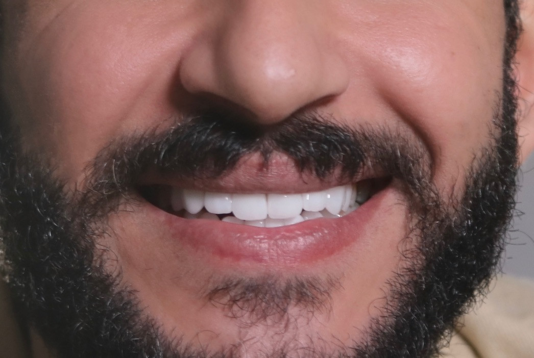 ابتسامه الايماكس الرائعة هدفنا القمه طريقنا التميز 🫶🏻 العنوان : المنصور - الاميرات - مقابل مطعم ست الشام ***********
