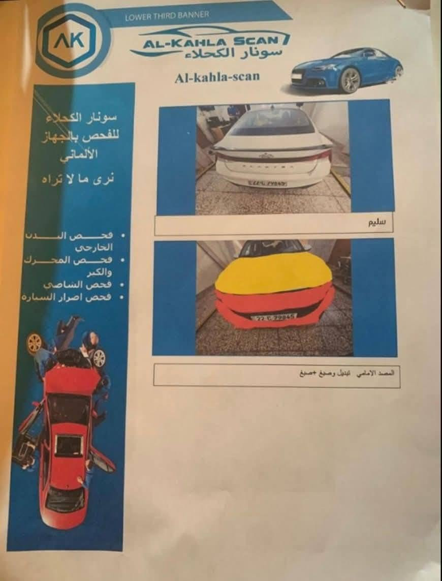 السلام عليكم
النترا موديل2021 أمريكي لون ابيض 
حادث جاملغ وبنيد بدون دواخل صور الحادث بالمنشور 
كير مكينة حدادية كفاله + الكير محور at  . 
المكينة 2000 دوش
مواصفات السيارة نص فول المعروفة 
رقم اربيل الدولي باسمي 
مكان السيارة بابل الحلة مركز المدينة 
للاستفسار الاتصال على الرقم 
آني مكلف بالنشر 
***********
.......
السعر 135 وبيها مجال
