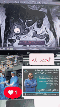 #متلازمة_مريزي
#الشرح_بالفيديو
#mirizzi_syndrome

كل الشكر ل كوادر مستشفى الحسين التعليمي في السماوة ... و تمت العملية في الجناح العام و لله الحمد ...

الجراح الاختصاص الدقيق د. علي عادل مجلي تخصص دقيق دكتوراه فوق الدكتوراه جراحة الجهاز الهضمي والكبد و البنكرياس و جراحة السمنة المفرطة و الجراحة المنظارية المتقدمة 

السماوة الغربي شارع مصرف الرشيد مقابل الخطوط الجوية العراقية للتواصل *********** او *********** و دمتم سالمين ...
