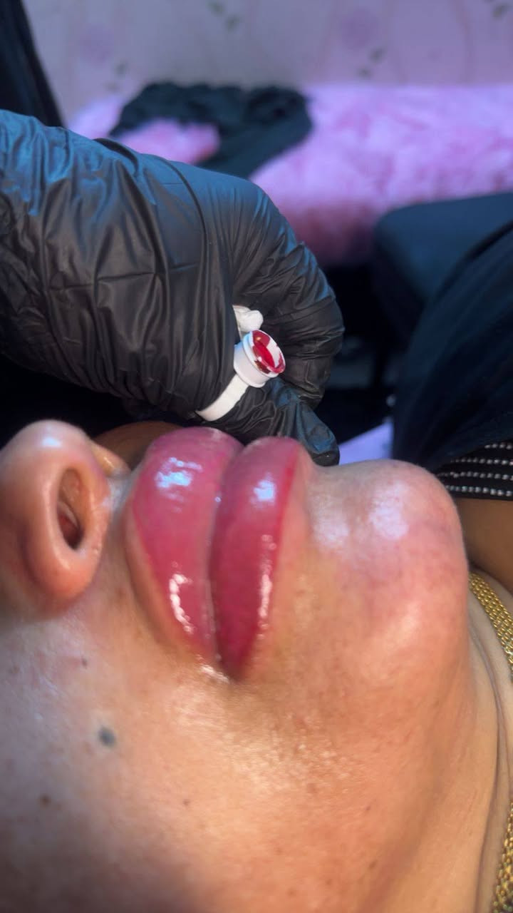 #جلسة_تانية_توريد_شفاف👄
أحلى و أقوى قرار رح تاخديه قبل العيد هوي توريد الشفاف ❤️
لانو العيد أحلى لما تختاري نفسك 🌸
النتيجة رح تكون شفايف وردية ، ثقة أعلى ، وراحة كل يوم بدون ماكياج 😍
للحجز تواصل عالدايركت او عالواتسآب ***********📲
