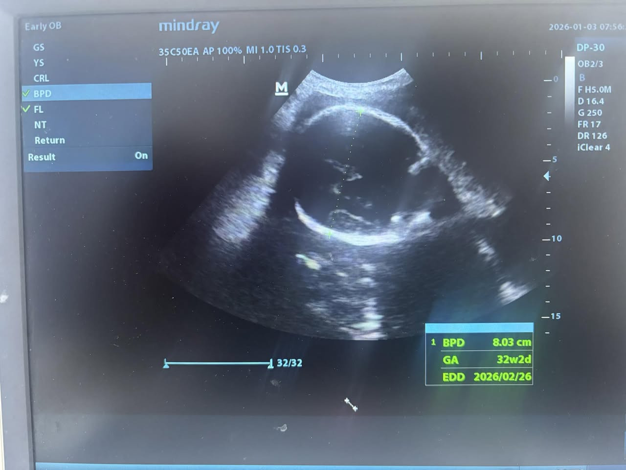 من حالات العياده
الي متابعه من الألف للياء وتطمن على سلامتها وسلامه النونو ربي يكونون بالسلامه ان شالله هي والنونو♥️🙏
ولد على ثنين بنوتات

د.انجي سعيد متي
بغداد/ابو دشير الشارع العام مجاور غذائيه ابو جواد
📍مجمع الحياه الطبي
كل ايام السبت والثنين واربعاء 
📩رقم الحجز ***********⁩
