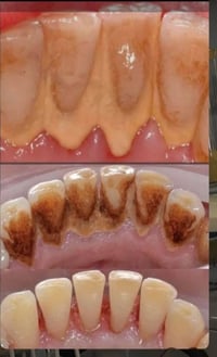 خدمات اسنان مجانية • عيادات الصفوة • كربلاء -حي النقيب