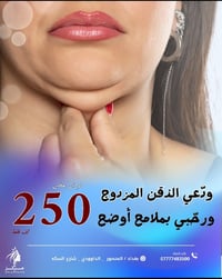✨ شفط الذقن المزدوج بسعر 250 ألف فقط 💎 إزالة الدهون تحت الذقن 💎 تحديد ...