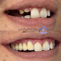 العالمي الطبي • تجميل الأسنان • قضاء النصر