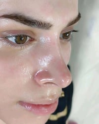 تفتيح بشرة • عناية البشرة • بغداد