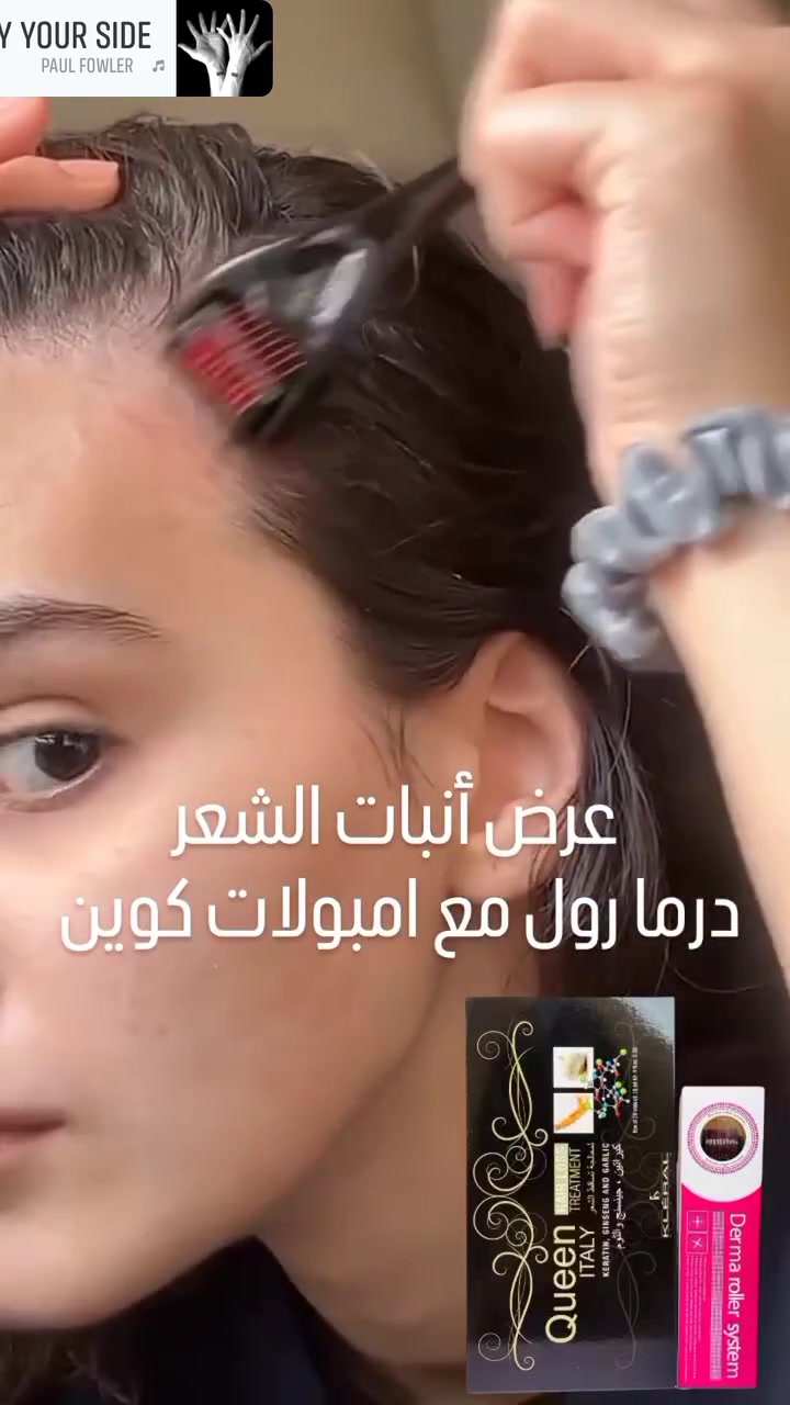 🤛عرض أنبات وتطويل الشعر الشعر  💙
 #أنبات  وتقوية البصيلات وتكثيف وتطويل🗯عرض أنبات الشعر  💙
أنبات  وتقوية البصيلات وتكثيف وتطويل #للشعر واللحيه درما رول مع امبولات كوين #الايطاليه 🇮🇹✌️لعلاج جميع مشاكل الشعر

1️⃣_بكج امبولات علاج تساقط الشعر وبطأ النمو والتقصف وضعف بصيلات الشعر امبولات كوين الايطاليه لوقف لتساقط الشعر وتعالج #ضعفه أبر كوين مصنوعة من الكرياتين و #جينسنج والثوم اعشاب طبيعية معالجه مضمونه للتساقط والتقصف وينظم عمل الغدد الدهنية بالاضافة الى تكييف فروة الرأس ومنع #عملية ترقق وضعف الشعر ويساعد على نمو #الشعر 

2️⃣-ديرما رول ✨
 #للوجه والشعر والجسم
تحفيز نمو الشعر وتساعد في انبات البصيلات
 #تحفيز نمو اللحية
 #تكثيف الشعر وتقوية الدورة الدموية في فروة الرأس
تعزيز تدفق الدم في فروة الرأس
كما يعمل على تحفيز إعادة نمو الشعر والتقليل من تساقطه
يحفز إنتاج الهرمونات التي تساعد على تقوية بصيلات الشعر وانتاج بصيلات شعر جديد

المنشأ ايطالي 🇮🇹
#سعر 47  الف   يحتوي على 20 امبوله وجهاز الديرما رول

متوفر توصيل كافة محافظات العراق 🚕مجاااااني @


**إذا كنت صاحب هذا الإعلان وتريد حذفه لأي سبب، رجاءا أرسل رسالة إلى الدعم الفني**