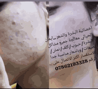 أخصائية البشرة والشعر 
ايمان الحيالي..
معالجة جميع مشاكل البشرة 
كلف/نمش/تصبغات/حبوب/مسامات/خطوط رفيعة 
وباسعار مناسبة جدا 
للاستفسار اكثر الاتصال على الرقم 
‏‪***********‬‏☎️📞
العنوان شارع الاربعتلاف مجمع الجوادين والصايغ محمد العكيلي الطابق الثالث 
@إشارة

