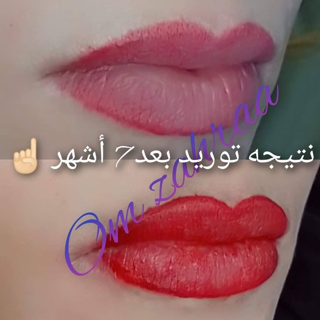 نتائج  توريد الشفه بأحبارنه 💕
تتوفر احبار التوريد    
وبسعر 15الف
توصيل بغداد ٥ محافظات 6
للحجز والأستفسار يرجى مراسلتي خاص  وتدللون ***********
