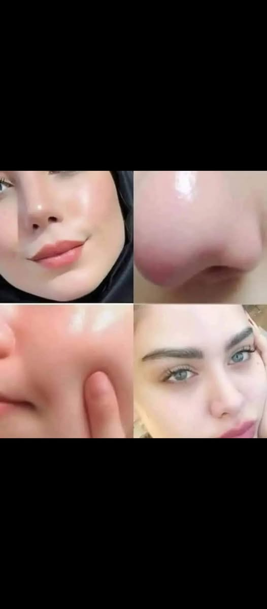 خلطه الوجه
في اسبوع فقط 
خلي وجهج يلمع 
🔅تبييض البشره
🔅توريد البشره
🔅 النضاره
🔅 الحبوب
🔅النمش
🔅الكلف 
تحل جميع مشاكل البشرة
تصفيه ونضاره وترطيب وتوريد
شتردون بعد 
 للحجز والاستفسار مراسله الصفحه***********

