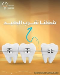 تقويم معدني • طبيب تقويم • بسماية